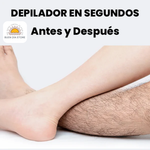 SoftGlow™ ✨ – Spray Depilador para Hombres y Mujeres - Depilación Sin Dolor 🌙